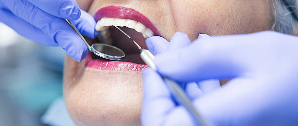 Best Emergency Tooth Extraction in La Fayette, AL
